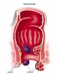 Image result for itchy skin rectum