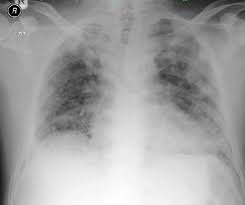 Image result for Pseudoeriosema