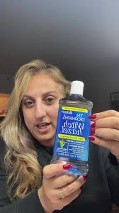 Witch Hazel Solutionlucky Review