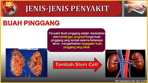 Objektif utama diet untuk tahap 3 penyakit buah pinggang kronik adalah untuk melambatkan perkembangan ckd dan merawat komplikasi yang orang dengan tahap 3 ckd harus mengelakkan pengambilan protein yang berlebihan. Baroqah Care