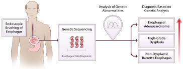 Diet is also potentially associated with. Procedures Identify Barrett S Esophagus Patients At Risk For Cancer Progression Eurekalert Science News