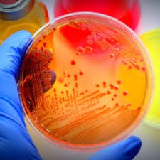 Coli are harmless and even help keep your. E Coli Infections Medlineplus