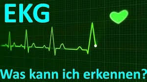Ekg geräte im test diese wearables warnen vor dem. Ekg Gerat Test Empfehlungen 07 21 Medmeister