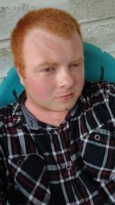 Person in the video talking about having eye surgery