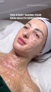 Ideal Skin Lexington