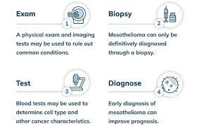 Mesothelioma Diagnosis | Diagnostic Tests, Early Detection & Process