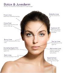 Botox Dental Diagram Wiring Schematic Diagram 12 Laiser Co