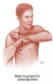 Image result for Lift-Off Subscapularis Test