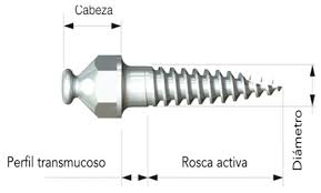 Resultado de imagen para IMAGENES DE MINI IMPLANTES DE ORTODONCIA