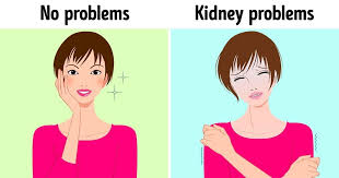 10 Non Obvious Signs That Your Kidneys Aren T Working Properly Chronic Kidney Disease Bone Fracture Kidney Disease