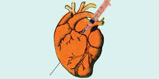 The signs, symptoms, and complications of heart inflammation depend on which type of heart inflammation you have. Is Heart Inflammation A Side Effect Of Covid Vaccine Cdc Is Studying Reports Of Myocarditis In Young People Health Com