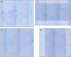 Such as png, jpg, animated gifs, pic art, logo, black and white, transparent, etc. Spatial Multi Omics Sequencing For Fixed Tissue Via Dbit Seq Star Protocols