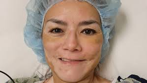 Fundraiser by Sonia Alcoser : Concussion recovery, trauma and vision therapy