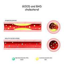 Borderline high is from 110 to 129 mg/dl while high is over 130 mg/dl. Lipid Profile Test Definition Procedure Range Blog