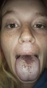 Guys, plz tell me this is… I was drinking my drink and noticed something in  my mouth and I used my finger to take it out and literally saw this….. plz  give