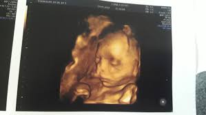 Peso Do Bebe Com 21 Semanas Dezembro De 2019 Babycenter