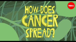 Waiting for your cancer treatment to start can bring up strong emotions. How Does Cancer Spread Through The Body Ivan Seah Yu Jun Youtube