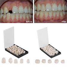 Pin On Dental