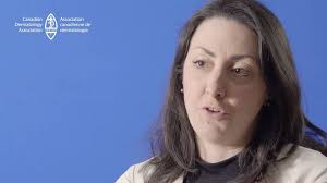 CDA President Dr. Kerri Purdy discusses the different types of #eczema, why  some professions have higher rates of developing contact dermatitis, the  wide range of symptoms that can be present in ...