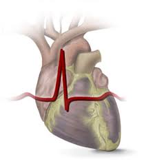 A pericardite aguda é uma inflamação súbita do pericárdio (a estrutura sacular flexível de camada dupla que envolve o coração), muitas vezes dolorosa, . Ecg Na Pericardite Aguda Cardiopapers