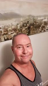 Hair (finally) coming back — first pic!