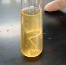 Comparison Of Liquid And Solid Bacterial Growth Media Growth Medium Microbiology Human Anatomy And Physiology