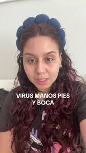 Understanding Hand, Foot, and Mouth Disease in Toddlers