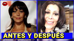 La cantante mexicana s e siente muy orgullosa de su cuerpo y así lo presume en sus redes sociales. Las 29 Cirugias De Alejandra Guzman Youtube