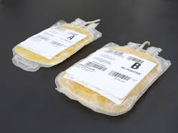Image result for Plasma Transfusion