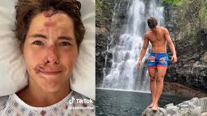 Caleb Coffee Talks to Fans After 80-Foot Fall Off Cliff