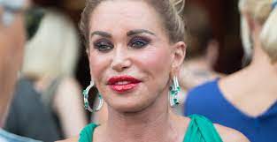 Connie plaatst regelmatig foto's en video's van leuke outfits, die bewonderd worden door haar ruim tachtigduizend. Zo Zag Connie Witteman Eruit Voor Alle Plastische Chirurgie