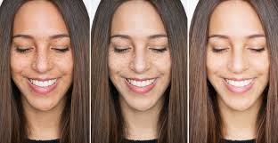 Top 10 Best Skin Lightening Soaps In 2020 Reviews
