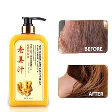 Isdin lambdapil anti hair loss shampoo. Old Ginger Shampoo Hair Care Professional Hair Scalp Treatment Healthy Hair Growth Smoothing Anti Hair Loss Anti Dandruff 500ml Ginger Shampoo Old Gingershampoo Hair Aliexpress
