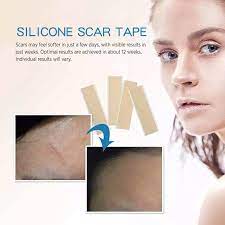 Directly cover the scar with the adhesive side. Silicone Scar Sheets Soften Flattens Scars Resulting From Surgery Injury Burns Acne C Section And More Soft Silicone Tape Medical Tape Aliexpress