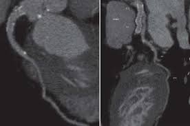 Multi detector ct imaging pdf free download. Cardiac Multislice Ct Springerlink