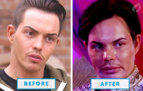 For a look celebrity plastic surgery and cosmetic procedures gone wrong, click through the gallery below! Top 10 Failed Celebrity Plastic Surgeries Mexico Cosmetic Center