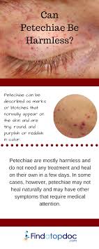 (macules/papules —> petechiae) and rapid deterioration •pallor, mottling, leg pain, or cold extremities are early sensitive signs •dic: What Is Petechiae And What Are Its Causes
