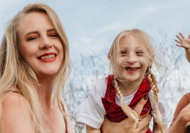 Menina com condição rara supera expectativas e encanta web: 'Nunca tinha  ouvido falar'