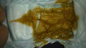 Suele pasar debido a que nuestro bebe no ha caca con mocos: Caquita Con Moco Foto Explicita Club De Septiembre 2015 Babycenter