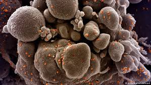 1, however, the city's health commissioner did report that there was a test being performed on a person under 40 who had returned from china, developed matching symptoms, and tested negative to the seasonal flu. Coronavirus Mutation No Reason To Panic Virologist Science In Depth Reporting On Science And Technology Dw 21 12 2020