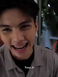 Fort Thitipong with Braces