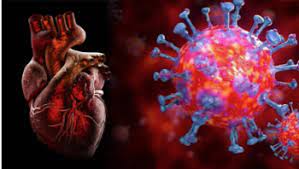 En la anamnesis se cita el antecedente de infección vírica reciente; Infomed Miocarditis En Covid 19 Complicacion Cardiaca Dificil De Definir
