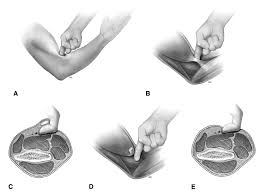Image result for Elbow Exam
