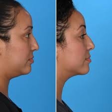 Dr. Bradley Hubbard (@bradleyhubbardmd) • Instagram photos and videos