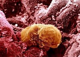 Sangrado De Implantacion O Menstruacion Como Diferenciarlos