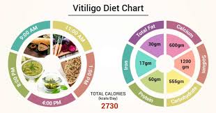 Diet Chart For Vitiligo Patient Vitiligo Diet Chart Lybrate