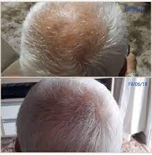 haare wachsen endlich nach haare wachsen schneller tolle haare haare