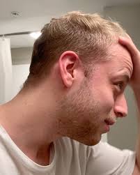 1 like, 1 comment & i’ll shave my head