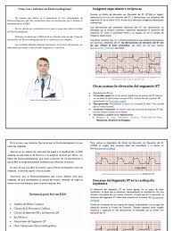 Report como leer un electrocardiograma. Como Leer E Informar Un Electrocardiograma Electrocardiografia Arritmia Cardiaca