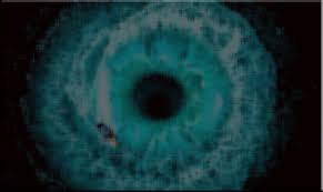 Maybe you would like to learn more about one of these? Eye Floaters After Cataracts Surgery Explained Eyes Advisor